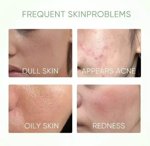 BUNDLING SKINTIFIC - Mugwort Acne Clay Stick + Alaska Volcano Pore Clay Stick #N - Picture 7 of 12