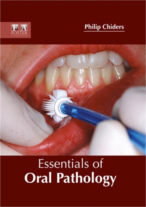 Essentials of Oral Pathology by Philip Chiders (2017, Hardcover)
