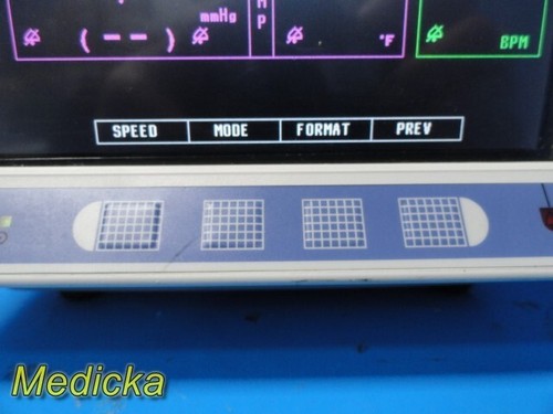 Larsen & Toubro Stellar 404 T (Temp, NBP, SPo2, Recorder) Patient Monitor ~33001 - Picture 7 of 22