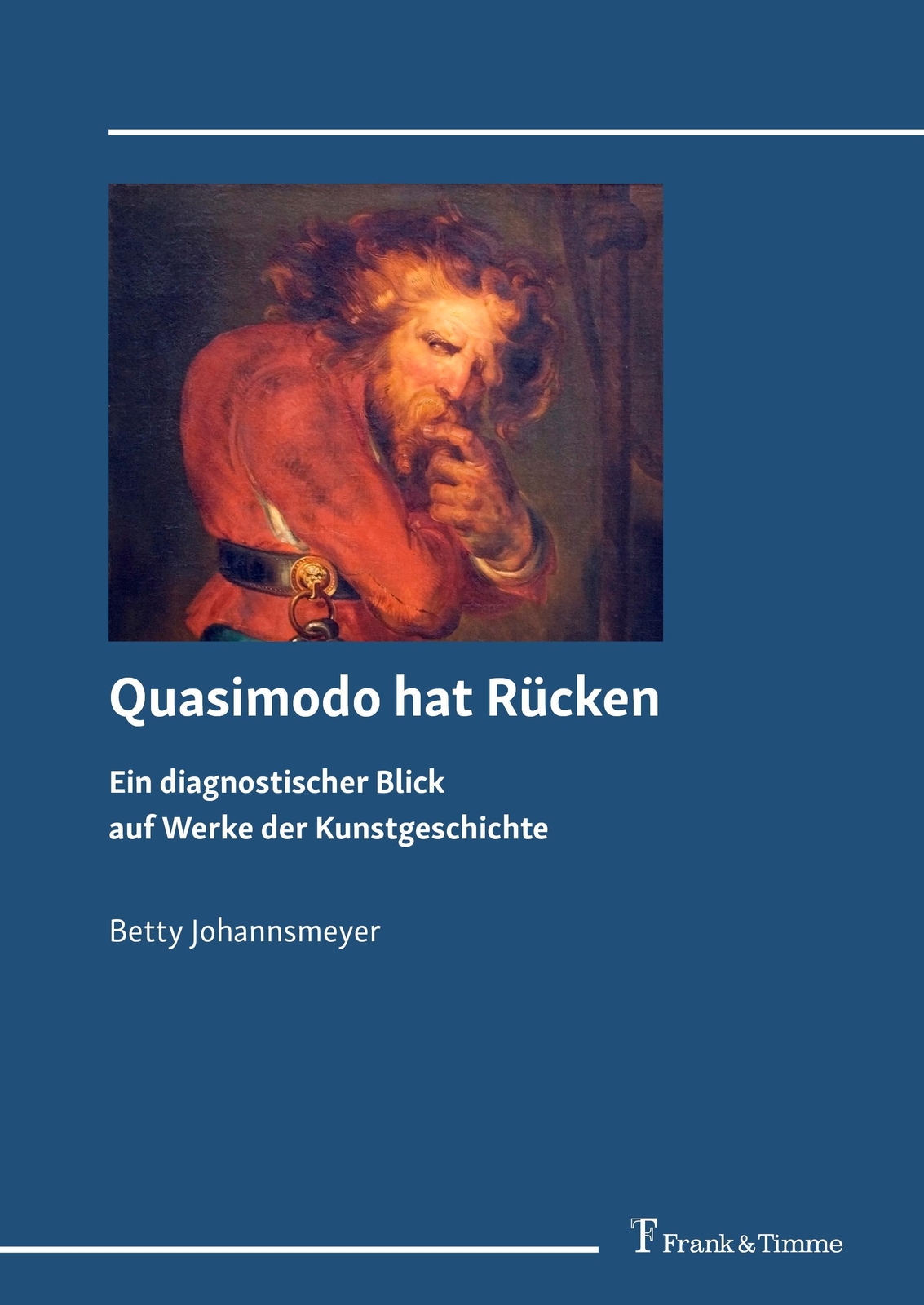 Quasimodo Hat Rücken | Ein Diagnostischer Blick Auf Werke Der