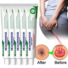 5/3X Hemorrhoids Remove Ointment Herbal Cream Relief Piles Pain Reduce Itching