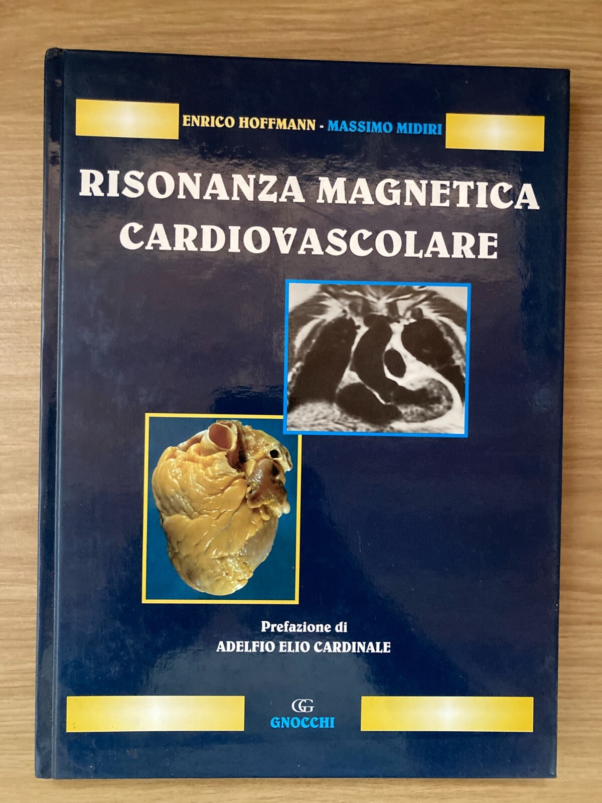 Herz-Kreislauf-MRT-Resonanztomographie Enrico Hoffman Maximum Midiiri