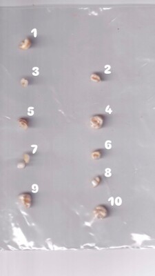 100% Authentic Human Deciduous (Milk) Teeth - Lot of 10 Molars and Fragments