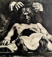 Rembrandt 1944 Anatomy Lesson Doctor Deijman Gravure Medical Phaidon Print DWU9