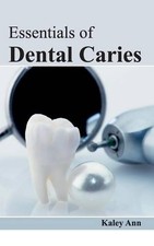Essentials of Dental Caries (Hardback) (UK IM...