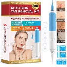 2in1 Micro Skin Tag Remover Device Kit Safe Painless Removal 2-8 mm Band Tool