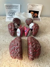 Budget Brain Model w/Arteries Life Size Dissect-able Parts w/ 2 Diagram Booklets