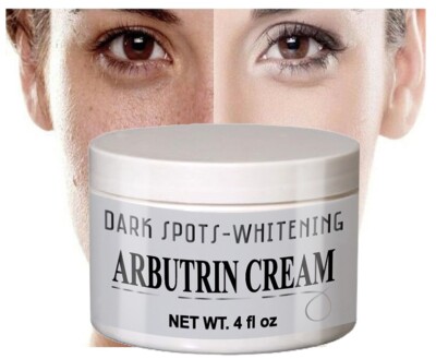 Remove freckle speckle peels dark spot face facial skin whitening cream Remove