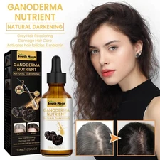 Black Ganoderma Lucidum Hair Essence – Prevent Hair Loss & Strengthen Roots 30ml