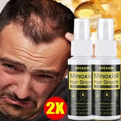 BOTASUN 2Stk MINOXIDIL 5% Extra Starke FÜR Männer Haarwachstum Behandlung Spray 60ml x 2