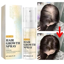  5X Halo Grow Hair Growth Spray, with Rosemary Biotin Ginseng for Hair Loss 60ml