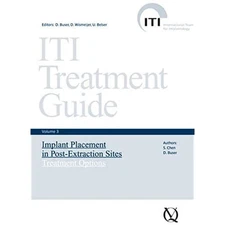 ITI Treatment Guide: Implant Placement in Post-Extraction Sites, Treatment O...