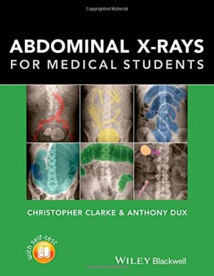 Abdominal X-rays for Medical Students (CourseSmart) by Clarke, Dux New+=