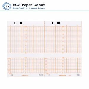 Ekg Chart