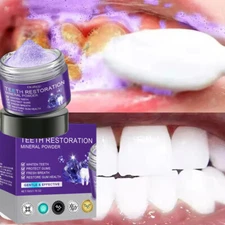 Dental Restoration Mineral Powder, Mineral Tooth Powder, Teeth Whitening-2025