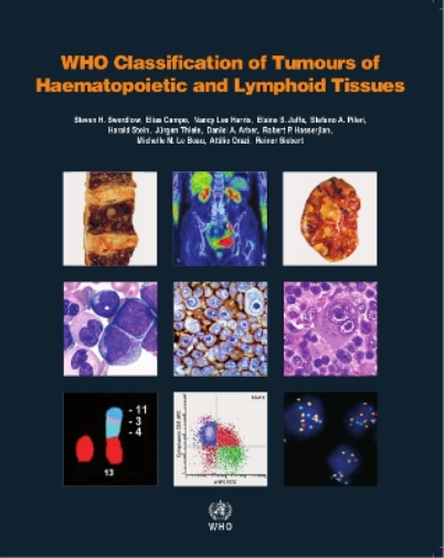 WHO classification of tumours of haematopoietic and lymphoid tissues (Tascabile)