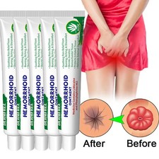 5/3X Hemorrhoids Remove Ointment Herbal Cream Relief Piles Pain Reduce Itching