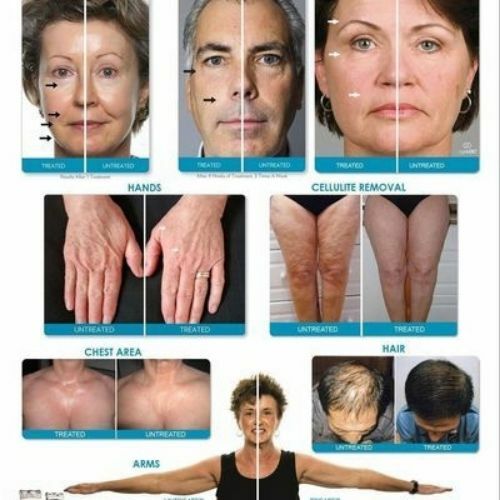 Nu Ageloc Body Gel Skin Shaping Nuskin Spa Treatment 150ml FDA Approved :20pcs - Picture 7 of 8