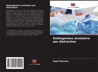 Rajat Mohanty | OstéOgenèSe AlvéOlaire Par Distraction | Taschenbuch (2021)