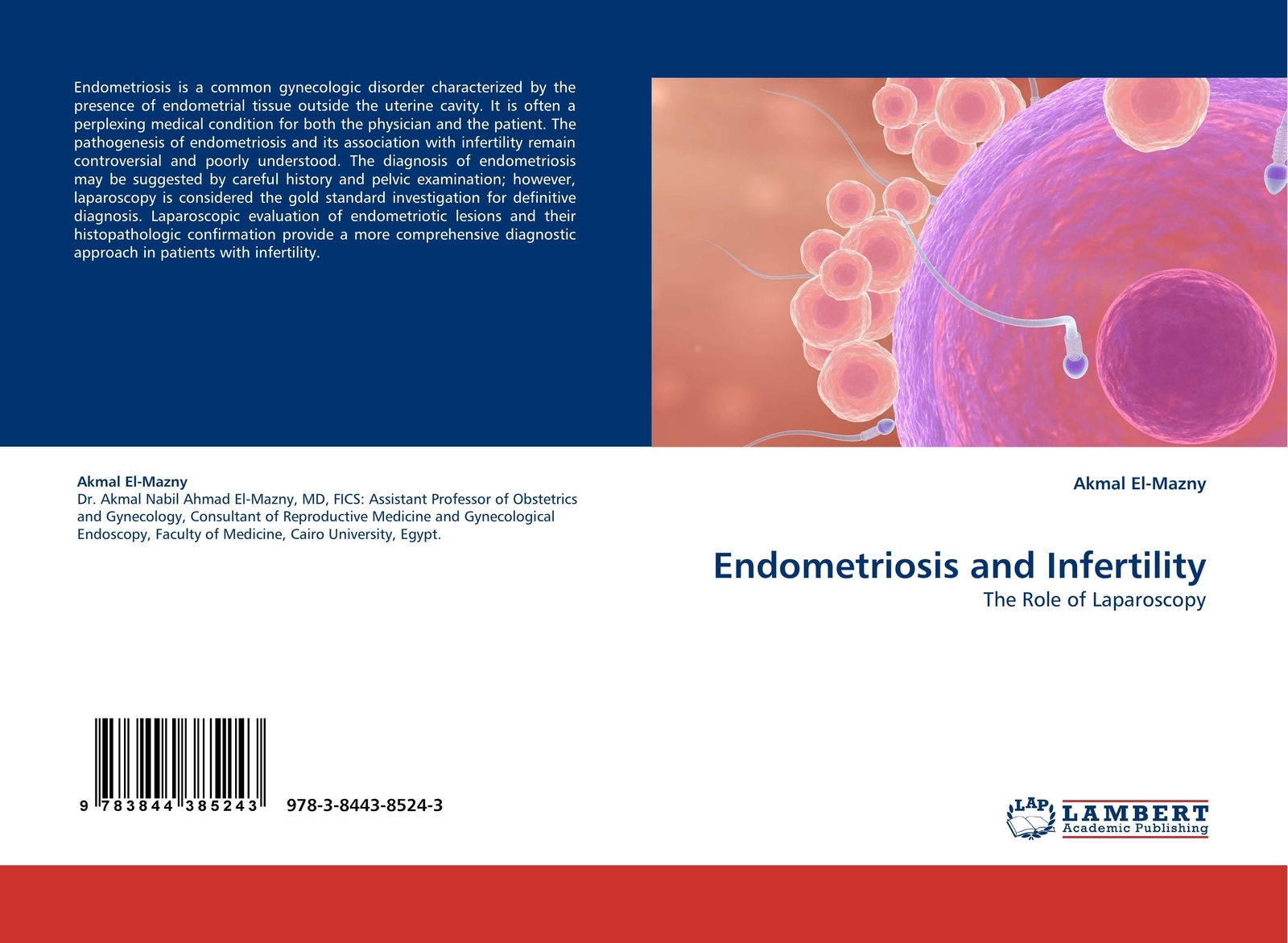 Thumbnail - Akmal El-mazny | Endometriosis And Infertility | Taschenbuch |