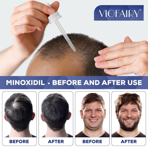 Tratamiento Eficaz para Hacer Crecer La Barba y Cabello - Crecimiento De Vellos - Bild 2 von 6