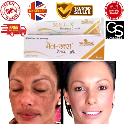 Wheezal Mel-X melasma Cream (25g) for skin pigmentation like melasma, chloasma