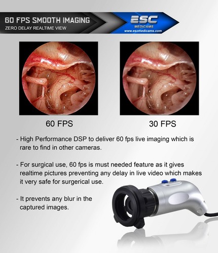 Endoscopy Camera Full HD 1080p Medical Laparoscopic Rigid Endoscope Unit - Picture 6 of 14
