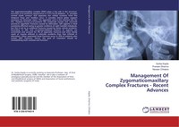 Sarika Kapila (U. A.) | Management Of Zygomaticomaxillary Complex Fractures -...