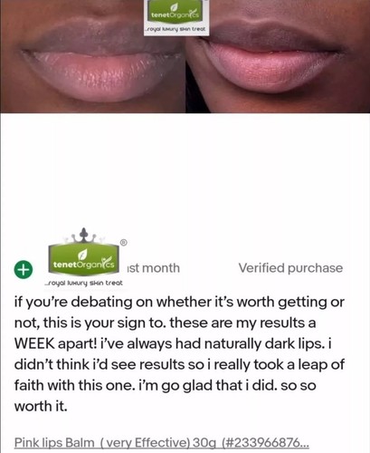 Pink Lips Balm(VERY EFFECTIVE) - Picture 9 of 10