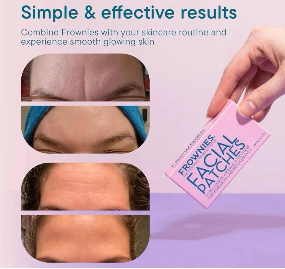 3 Pack Frownies Facial Patches for Forehead & Between Eyes Smooths  3 X  144 Ct - Image 4 of 4