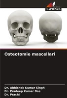 Osteotomie Mascellari Abhishek Kumar Singh (U. A.) Taschenbuch Italienisch 2025