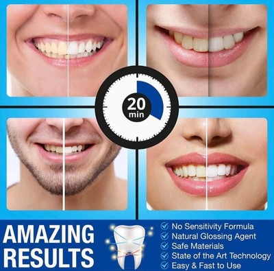 Zahnaufhellungsset Light Tray Zahnaufheller +Bleaching 56 Streifen + 30 Zahnpasta