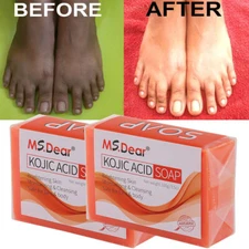 2PCS Kojic Acid Soap Acne Dark Spot Remover Skin Lightening Whitening Face Body