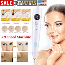 Electric Laser Plasma Pen Mole Removal Dark Spot Remover Skin Wart Tag Tattoo US