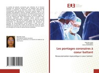 Les Pontages Coronaires à Coeur Battant HèLa Ben Jmaà