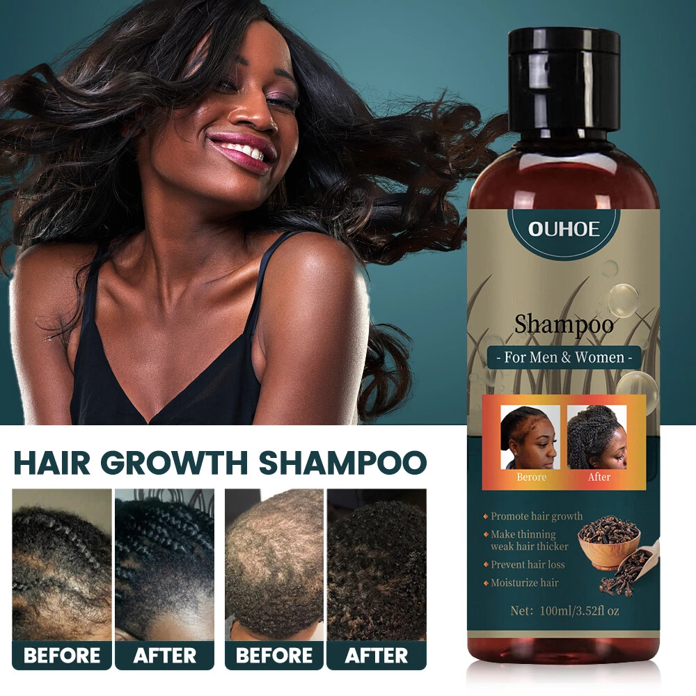 Hair loss treatment for men deals