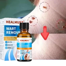 HEALMUSZ Wart Remover Liquid Skin Tags Mole Remover Eliminate Foot Corn Wart
