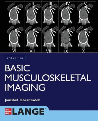 Jamshid Tehranzadeh | Basic Musculoskeletal Imaging, Second Edition | Buch