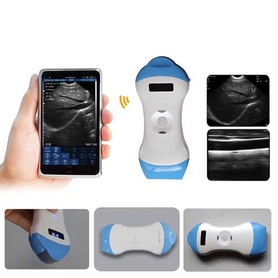 Wireless Ultrasound Scanner Dual Head Micro Convex & Linear Probe | iOS Android