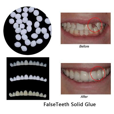 3 Stück Zahnprothesen Veneers mit Thermobeschlag Perlen temporäre falsche Zähne