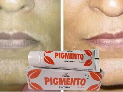 Charak Pigmento Ointment (50gm) for Vitiligo, Pigmentation 100% Herbal