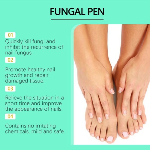 Pluma antimicótica - 25% ácido undecilénico, tratamiento de hongos en las uñas de los pies fuerza extra - Imagen 11 de 12