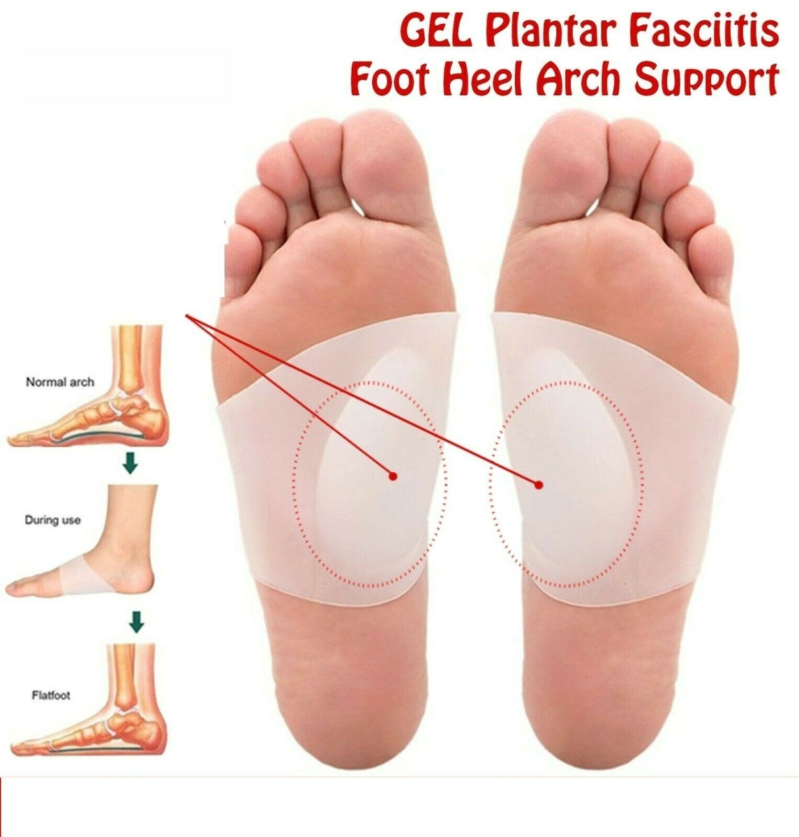 GEL Plantar Fasciitis Foot Heel Arch Support Sleeve Pain Relief
