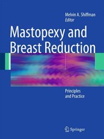Melvin A. Shiffman | Mastopexy And Breast Reduction | Taschenbuch | Englisch