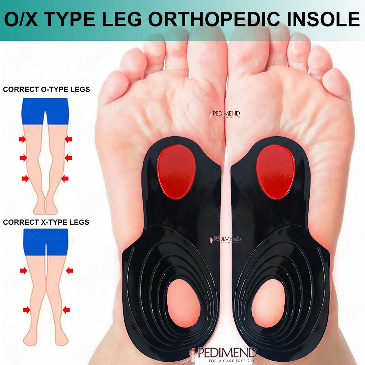 Pedimend™ O/X Type Legs Orthopedic Insole for Knock Knee Pain Relief Bow  Legs - Main Image