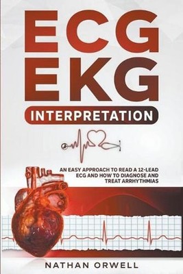 ECG/EKG Interpretation: An Easy Approach to Read a 12-Lead ECG and How to Diagno
