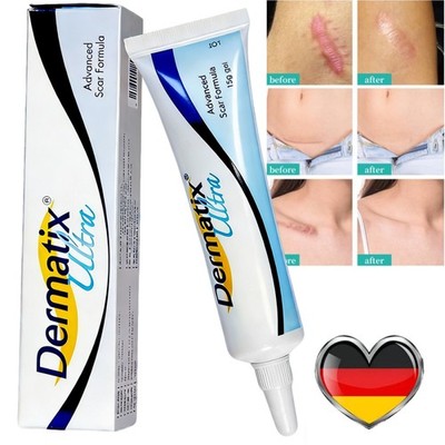 Silicone Scar Gel Stretch Marks Removal Cream Skin Care Scars Cream Nice 15g NEU