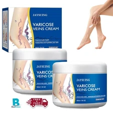 Varicose Veins Cream Spider Veins Repair Cream Varicose & Spider Veins Leg Cr...