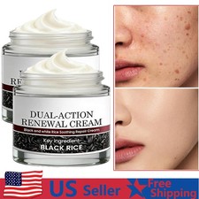 Black Rice Soothing Cream, 60g Keraerase Dual- Action Renewal Cream US 20 OFF