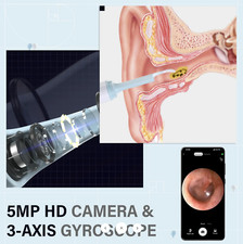 Smart Visual Ear Wax Removal Pick Led Wireless Ear Camera Otoscope eXempt